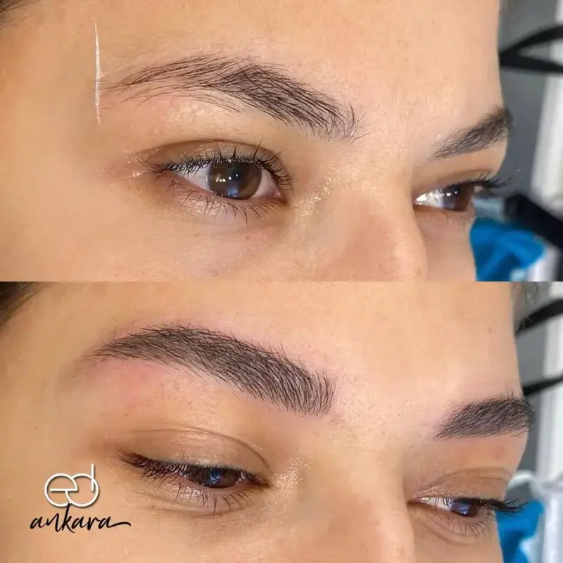 microblading-oncesi-sonrasi-1-emsal-dogan-ankara (1)