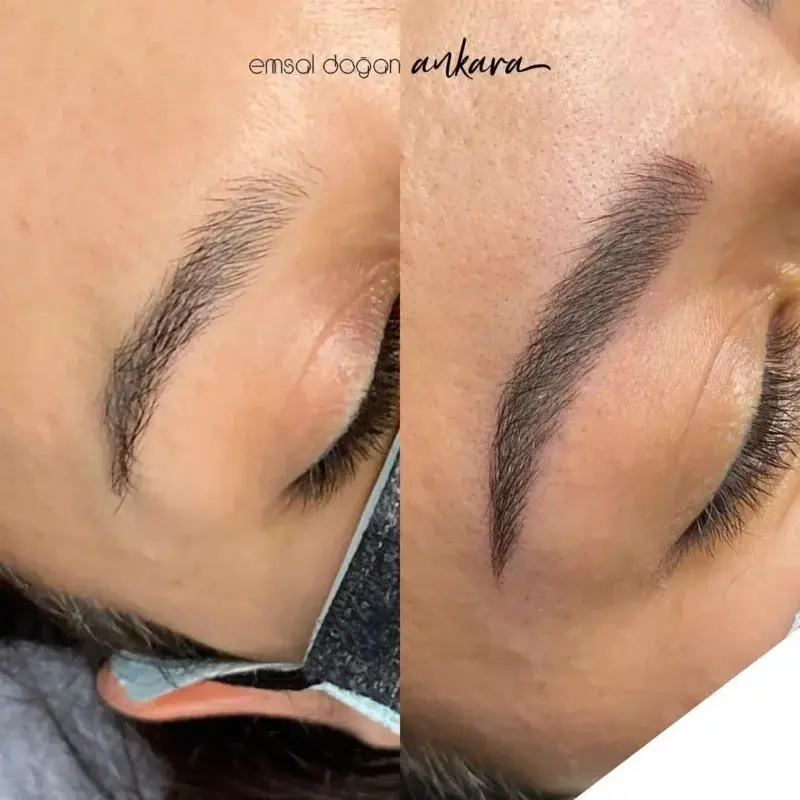 microblading-oncesi-sonrasi-2-emsal-dogan-ankara